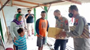 Polisi Peduli, Polres Bojonegoro Berikan Bantuan Pengobatan Bocah Cacat Sejak Lahir