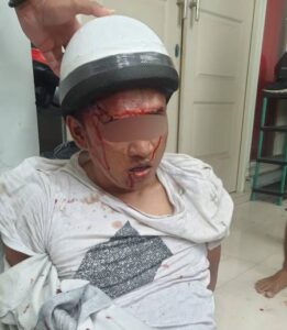 Polisi Surabaya Selamatkan Nyawa Maling Motor Yang Tertangkap Warga