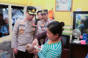 Kapolres Situbondo Beri Santunan Bayi Penderita Meningokel