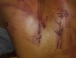 Merasa Jadi Korban Dugaan Penyekapan Dan Penganiayaan Oleh Operator Pom,Warga Sukokerto Jember Lapor Polisi,Ini Kata Kasi Humas Polres Bondowoso