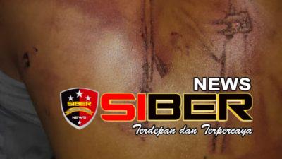 Merasa Jadi Korban Dugaan Penyekapan Dan Penganiayaan Oleh Operator Pom,Warga Sukokerto Jember Lapor Polisi,Ini Kata Kasi Humas Polres Bondowoso